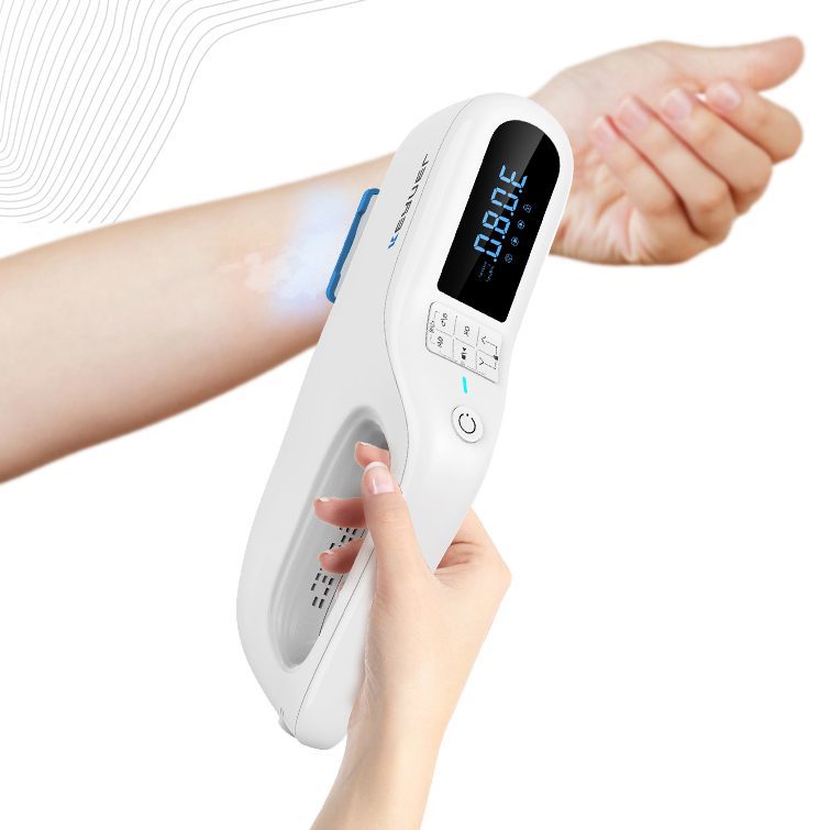 Thérapie par lumière UV pour le vitiligo au laser portable XeCl 308 nm KN-5000F