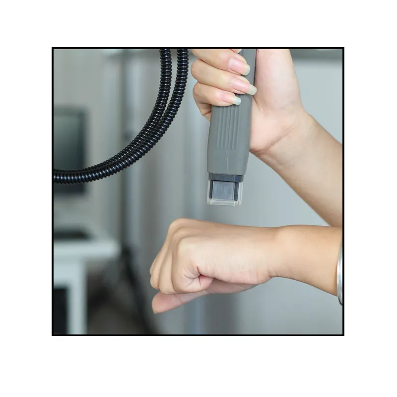 Photothérapie au laser excimère ciblée de 308 nm pour le psoriasis KN-5000B