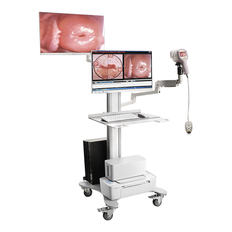 Full HD Gynecological Digital Video Colposcope Equipment KN-2200IH Optional Two Screens