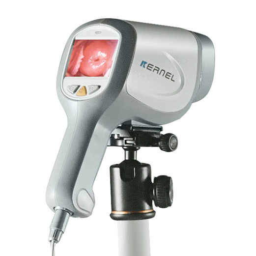 digital colposcope