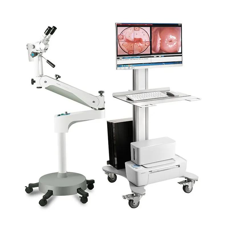 Vidéocolposcope optique pour système d'imagerie d'examen gynécologique KN-2200B