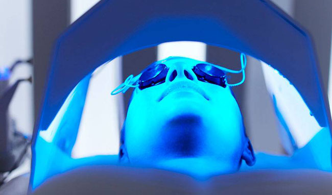 5 Key Points You need to Know aout UVB Phototherapy Updated 2023