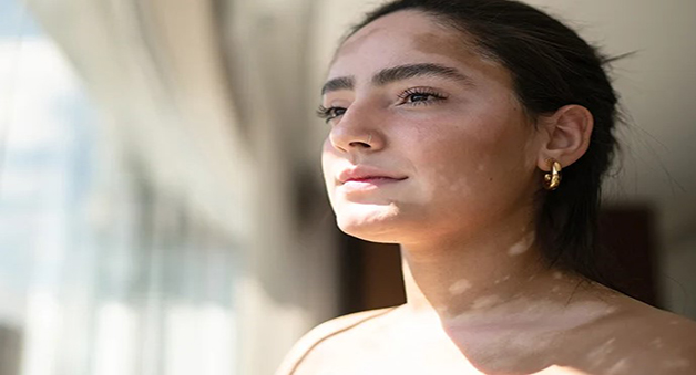 Les bains de soleil sont-ils utiles pour traiter le vitiligo ?