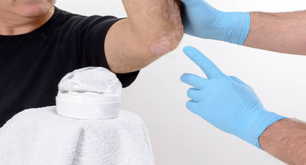 Conhecimentos básicos sobre psoríase e fototerapia