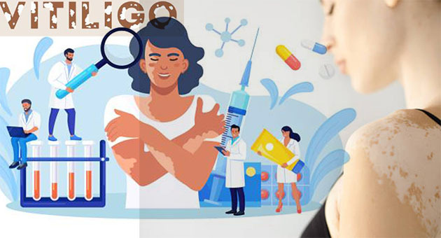 Ocak ayında Dünya'da Vitiligo Tedavisinde 3 Büyük Gelişme