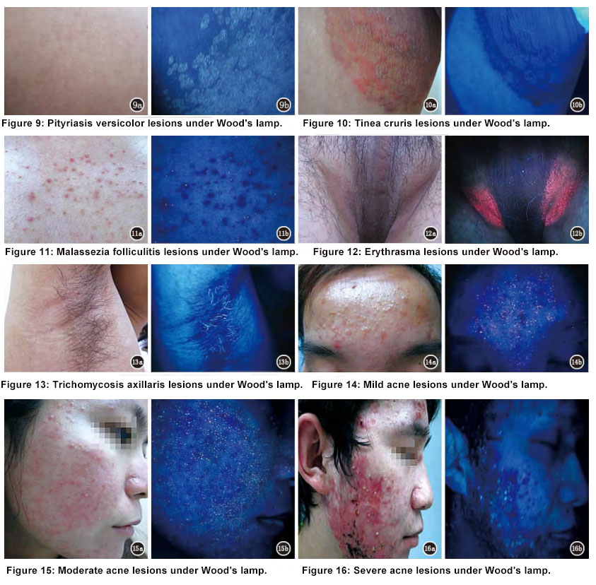 skin disease diagnosis