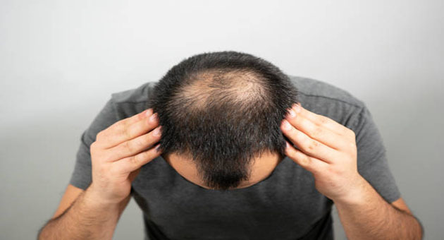 Una guida completa alla gestione della salute dei capelli: ultime novità per settembre 2024