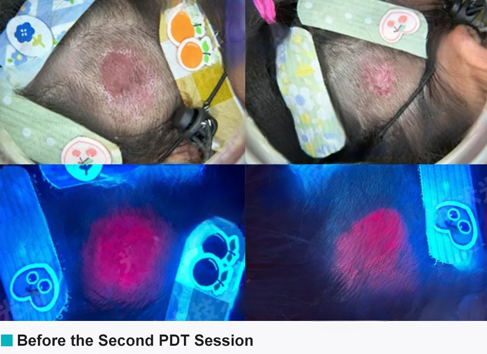 pediatric dermatology