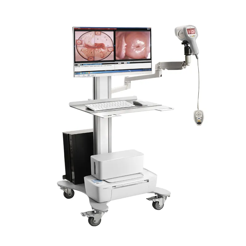 Sistema de imagem de colposcópio de vídeo digital KN-2200I