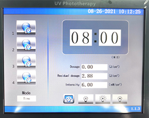 311nm uvb light