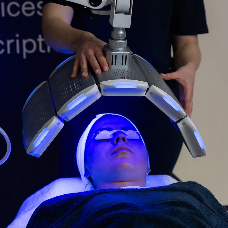 LED photodynamic therapy acne