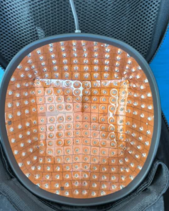 non-invasive hair regrowth