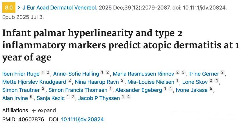 alopecia areata JAK inhibitor therapy alopecia areata JAK inhibitor therapy