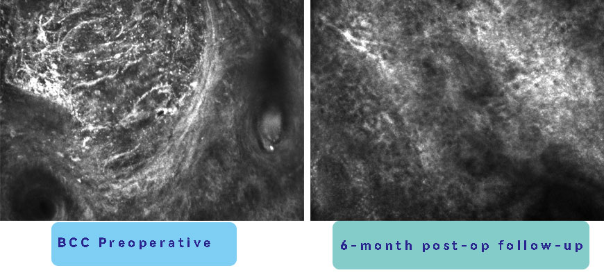 Non-invasive skin diagnosis Non-invasive skin diagnosis