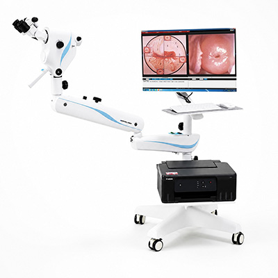 Colposcope for Cervical Examination Colposcope for Cervical Examination