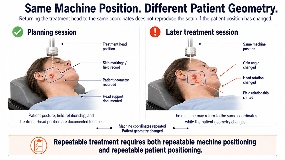 superficial radiation therapy