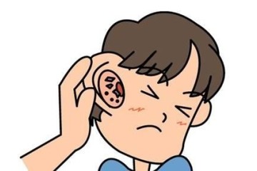 WHO: About 1.1 billion young people worldwide face hearing loss